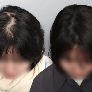 더그레이