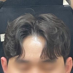 노드맨즈헤어