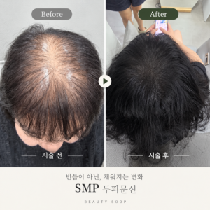 뷰티숲